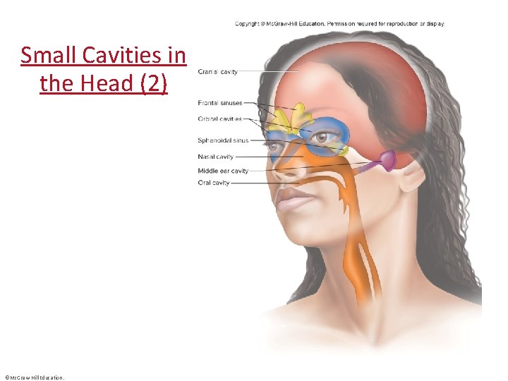 Small Cavities in the Head (2) ©Mc. Graw-Hill Education. 