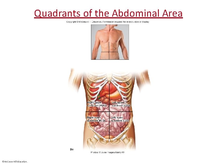 Quadrants of the Abdominal Area ©Mc. Graw-Hill Education. 