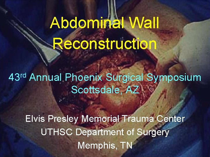 Abdominal Wall Reconstruction 43 rd Annual Phoenix Surgical Symposium Scottsdale, AZ Elvis Presley Memorial