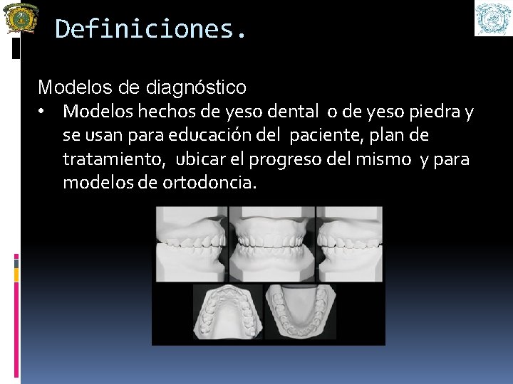 Definiciones. Modelos de diagnóstico • Modelos hechos de yeso dental o de yeso piedra