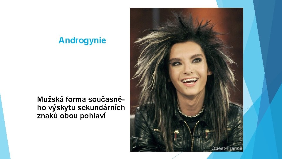 Androgynie Mužská forma současného výskytu sekundárních znaků obou pohlaví 