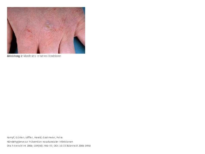 Kampf, Günter; Löffler, Harald; Gastmeier, Petra Händehygiene zur Prävention nosokomialer Infektionen Dtsch Arztebl Int