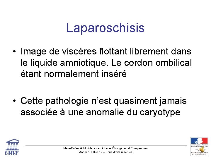 Laparoschisis • Image de viscères flottant librement dans le liquide amniotique. Le cordon ombilical