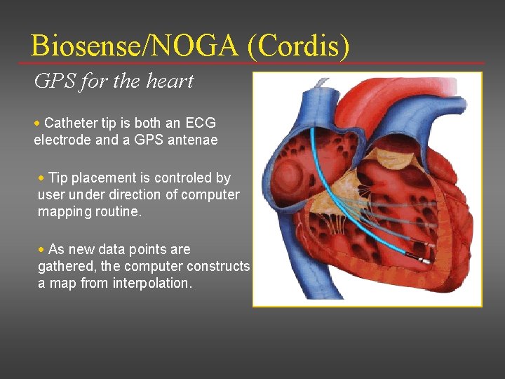 Biosense/NOGA (Cordis) GPS for the heart · Catheter tip is both an ECG electrode