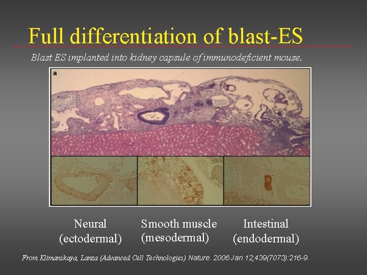 Full differentiation of blast-ES Blast ES implanted into kidney capsule of immunodeficient mouse. Neural