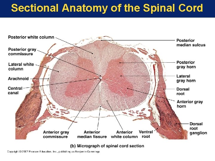 Sectional Anatomy of the Spinal Cord 