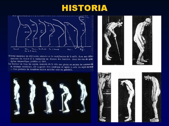 HISTORIA HISTORIA