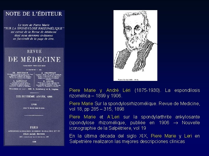 Piere Marie y André Léri (1875 -1930). La espondilosis rizomélica – 1899 y 1906. Piere Marie y André Léri (1875 -1930). La espondilosis rizomélica – 1899 y 1906.