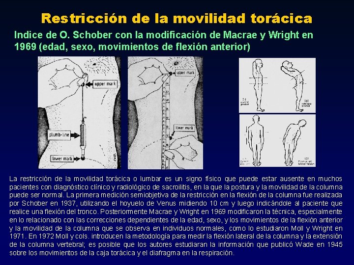 Restricción de la movilidad torácica Indice de O. Schober con la modificación de Macrae Restricción de la movilidad torácica Indice de O. Schober con la modificación de Macrae