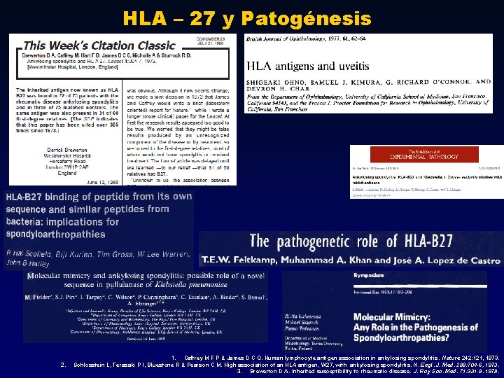 HLA – 27 y Patogénesis 2. 1. Caffrey M F P & James D HLA – 27 y Patogénesis 2. 1. Caffrey M F P & James D