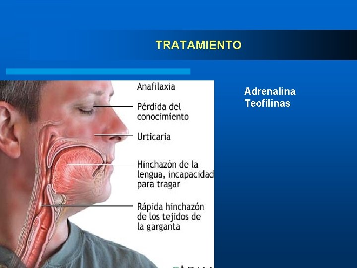 TRATAMIENTO Adrenalina Teofilinas EQUIPO CÁNCER 