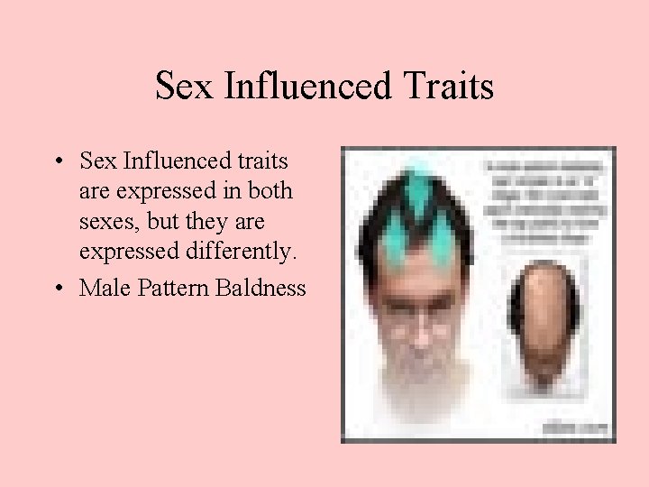 Sex Influenced Traits • Sex Influenced traits are expressed in both sexes, but they