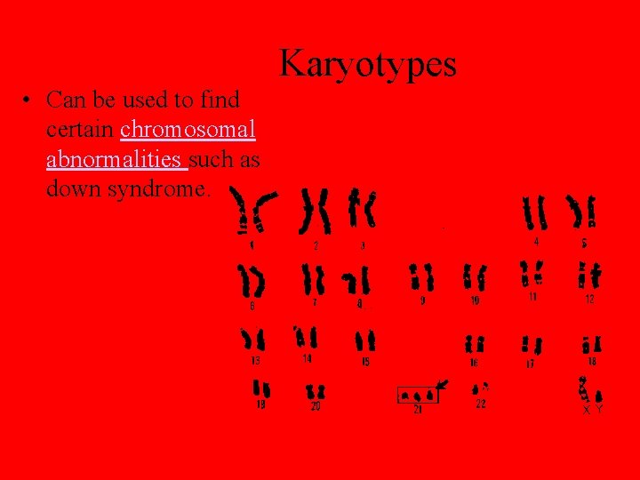 Karyotypes • Can be used to find certain chromosomal abnormalities such as down syndrome.