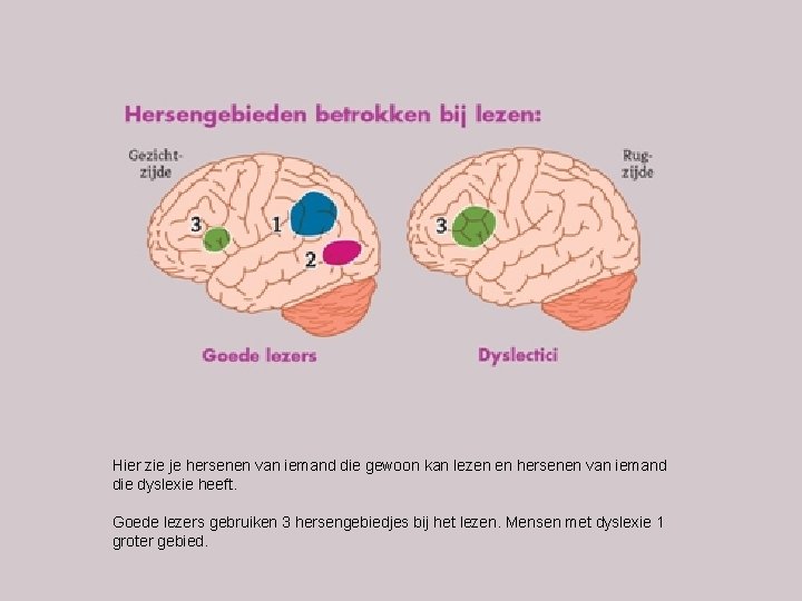 Hier zie je hersenen van iemand die gewoon kan lezen en hersenen van iemand