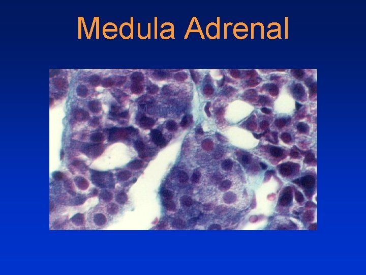 Medula Adrenal Medula Adrenal