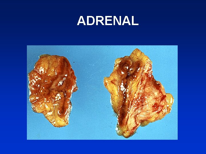 ADRENAL 