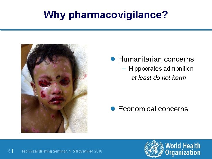 Why pharmacovigilance? l Humanitarian concerns – Hippocrates admonition at least do not harm l Why pharmacovigilance? l Humanitarian concerns – Hippocrates admonition at least do not harm l