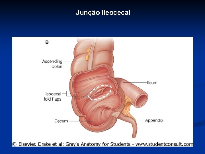 Junção ileocecal 
