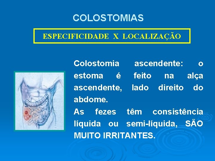 COLOSTOMIAS ESPECIFICIDADE X LOCALIZAÇÃO Colostomia ascendente: o estoma é feito na alça ascendente, lado