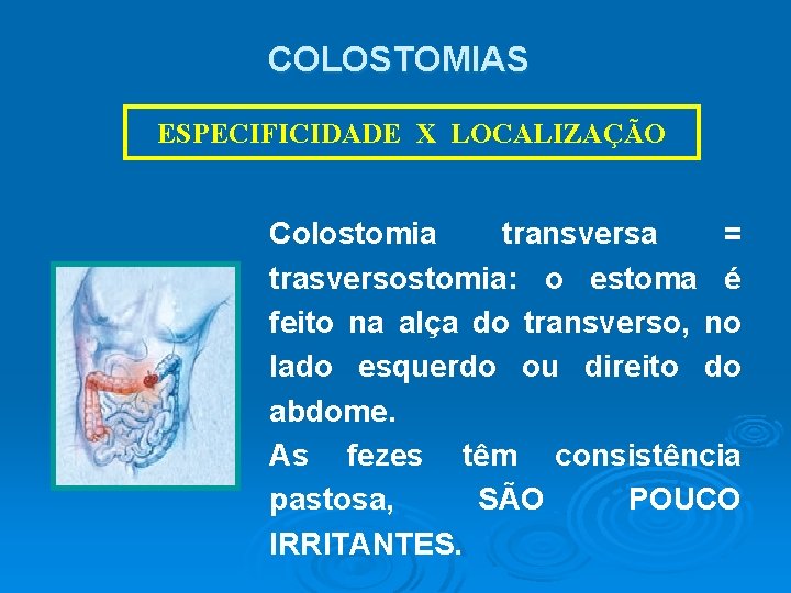 COLOSTOMIAS ESPECIFICIDADE X LOCALIZAÇÃO Colostomia transversa = trasversostomia: o estoma é feito na alça