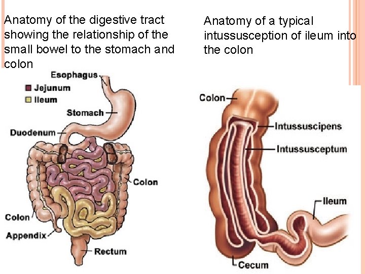 Anatomy of the digestive tract showing the relationship of the small bowel to the