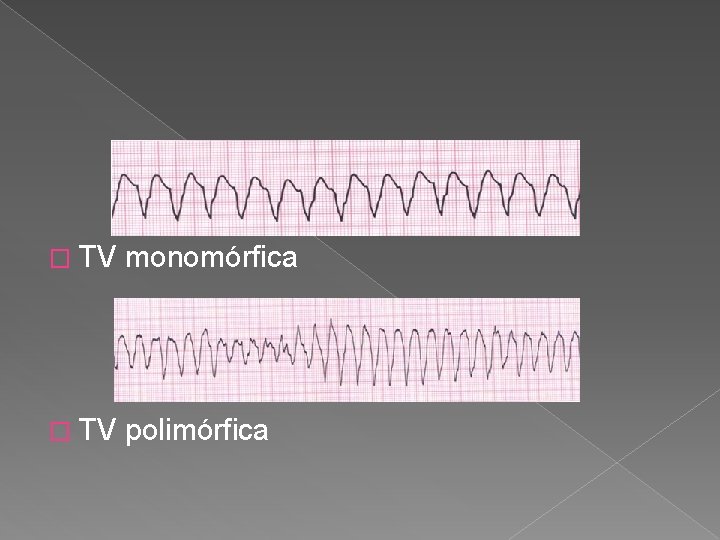 � TV monomórfica � TV polimórfica 