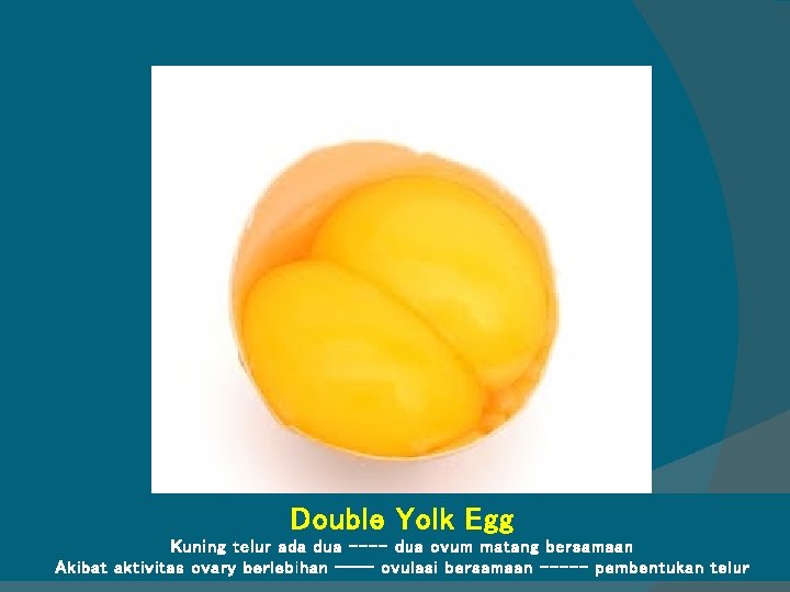 Double Yolk Egg Kuning telur ada dua ---- dua ovum matang bersamaan Akibat aktivitas