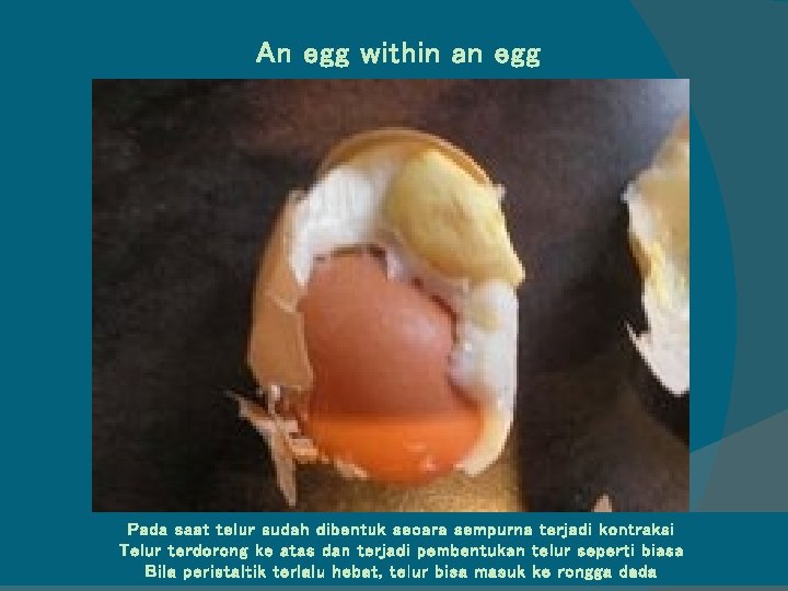 An egg within an egg Pada saat telur sudah dibentuk secara sempurna terjadi kontraksi