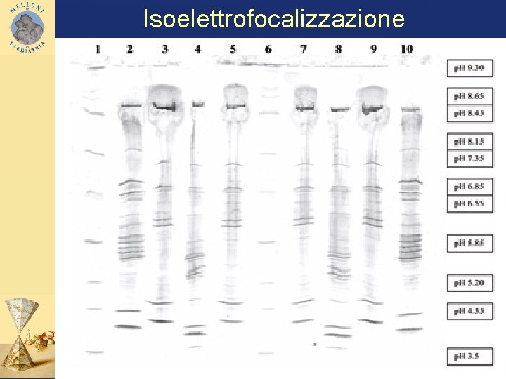 Isoelettrofocalizzazione 