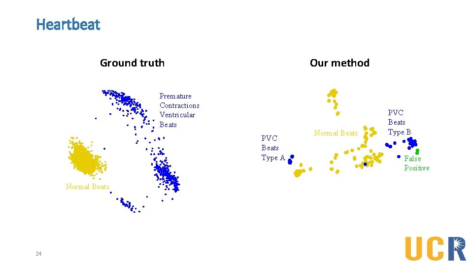 Heartbeat Ground truth Our method Premature Contractions Ventricular Beats PVC Beats Type A Normal