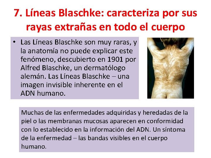 7. Líneas Blaschke: caracteriza por sus rayas extrañas en todo el cuerpo • Las