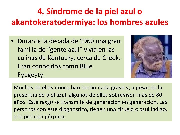 4. Síndrome de la piel azul o akantokeratodermiya: los hombres azules • Durante la