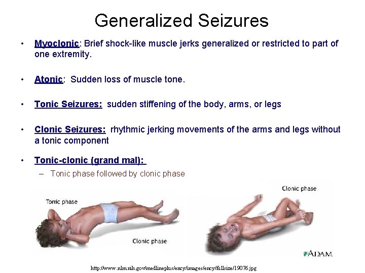 Generalized Seizures • Myoclonic: Brief shock-like muscle jerks generalized or restricted to part of