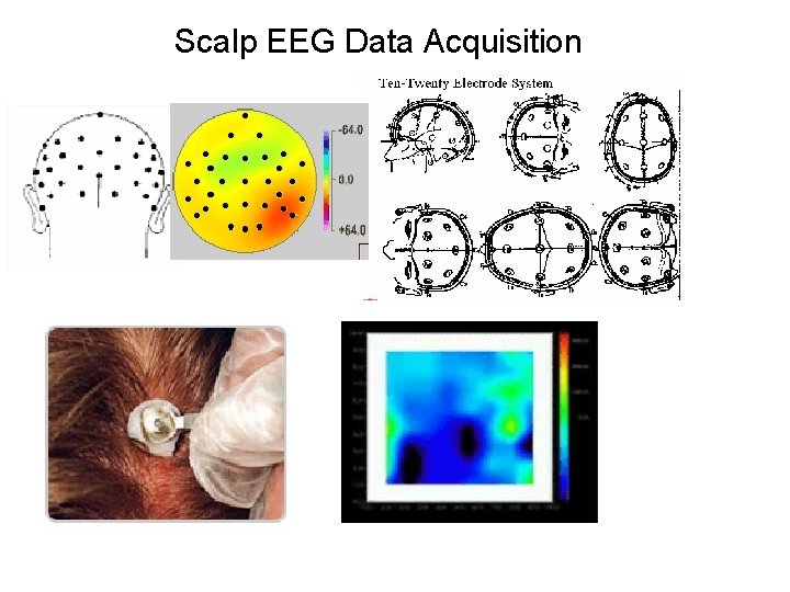 Scalp EEG Data Acquisition 