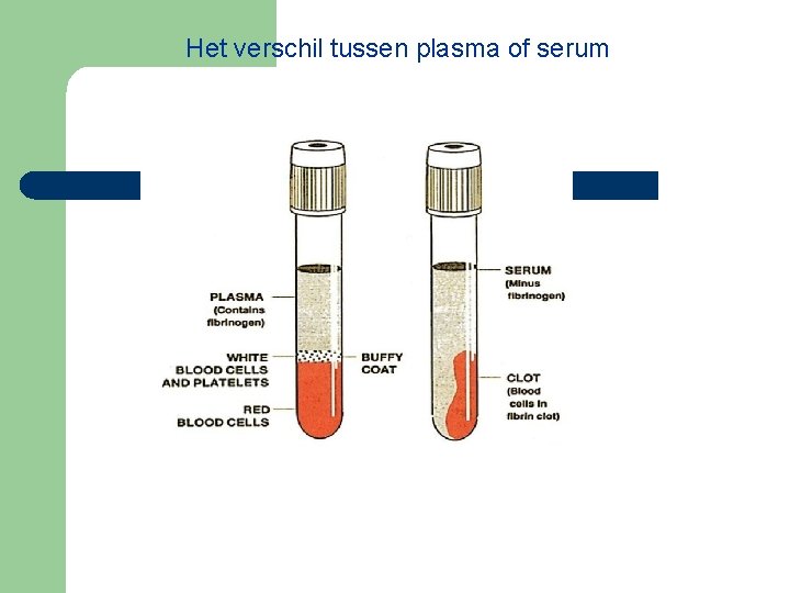 Het verschil tussen plasma of serum 