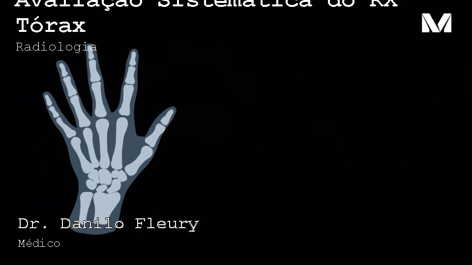 Avaliação Sistemática do RX Tórax Radiologia Dr. Danilo Fleury Médico Avaliação Sistemática do RX Tórax Radiologia Dr. Danilo Fleury Médico