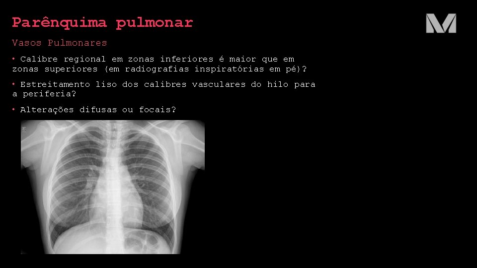 Parênquima pulmonar Vasos Pulmonares • Calibre regional em zonas inferiores é maior que em Parênquima pulmonar Vasos Pulmonares • Calibre regional em zonas inferiores é maior que em