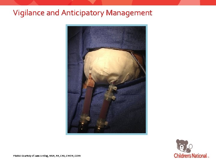 Vigilance and Anticipatory Management Photos Courtesy of June Amling, MSN, RN, CNS, CWON, CCRN