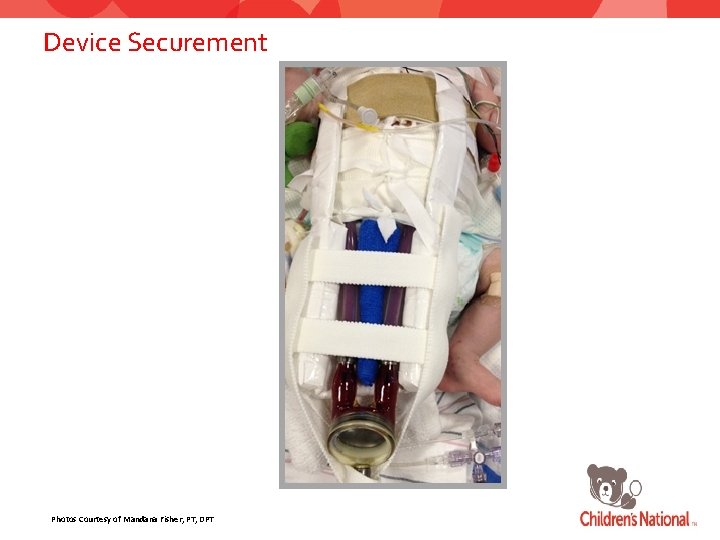Device Securement Photos Courtesy of Mandana Fisher, PT, DPT 