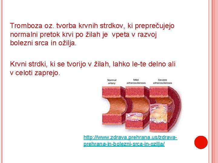 KORONARNA OBOLENJA ALI Tromboza oz. tvorba krvnih strdkov, ki preprečujejo TROMBOZA normalni pretok krvi