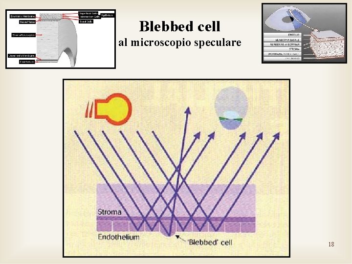 Blebbed cell al microscopio speculare 18 