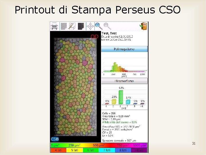 Printout di Stampa Perseus CSO 31 