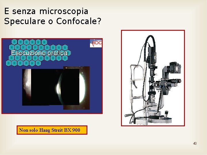 E senza microscopia Speculare o Confocale? Non solo Haag Streit BX 900 40 