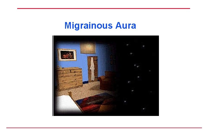 Migrainous Aura 