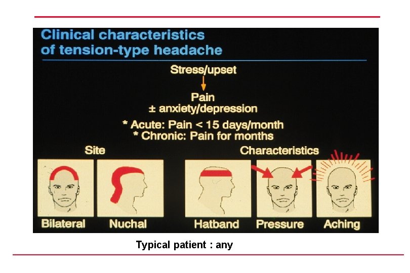 Typical patient : any 