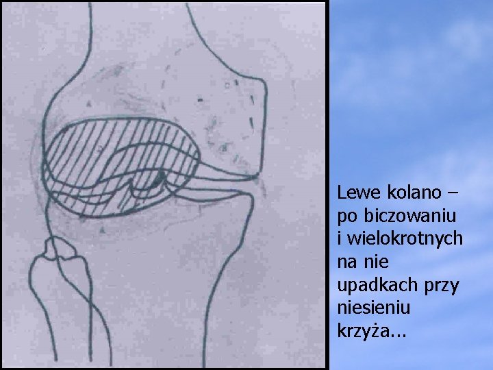 Lewe kolano – po biczowaniu i wielokrotnych na nie upadkach przy niesieniu krzyża. .