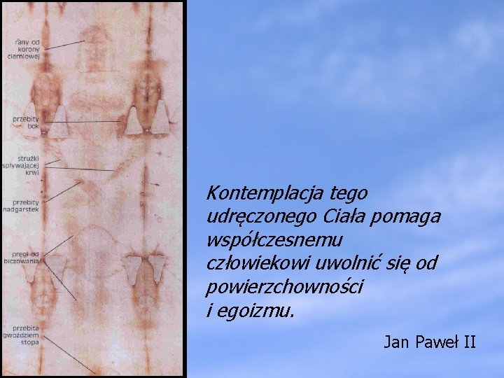 Kontemplacja tego udręczonego Ciała pomaga współczesnemu człowiekowi uwolnić się od powierzchowności i egoizmu. Jan