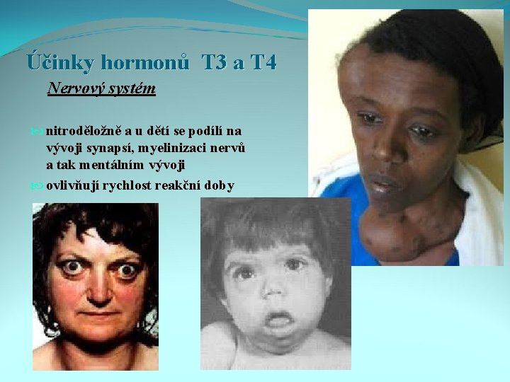Účinky hormonů T 3 a T 4 Nervový systém nitroděložně a u dětí se