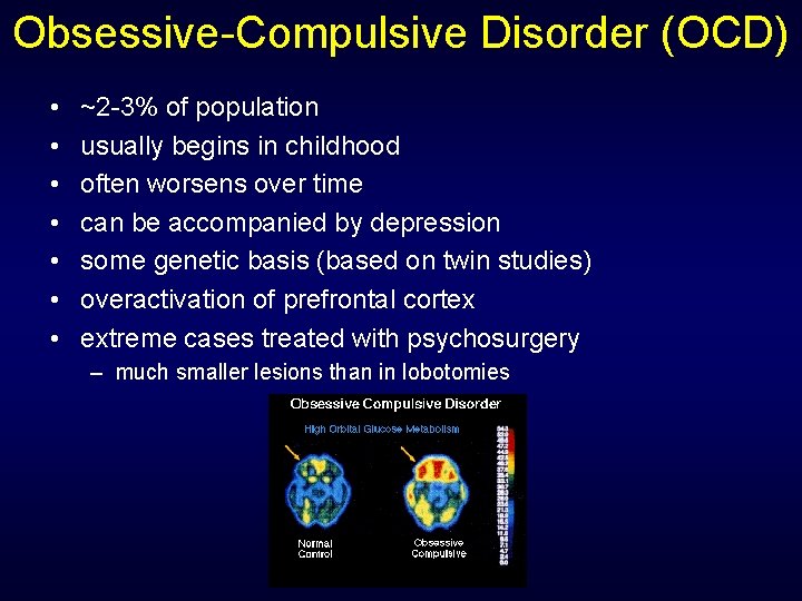 Obsessive-Compulsive Disorder (OCD) • • ~2 -3% of population usually begins in childhood often