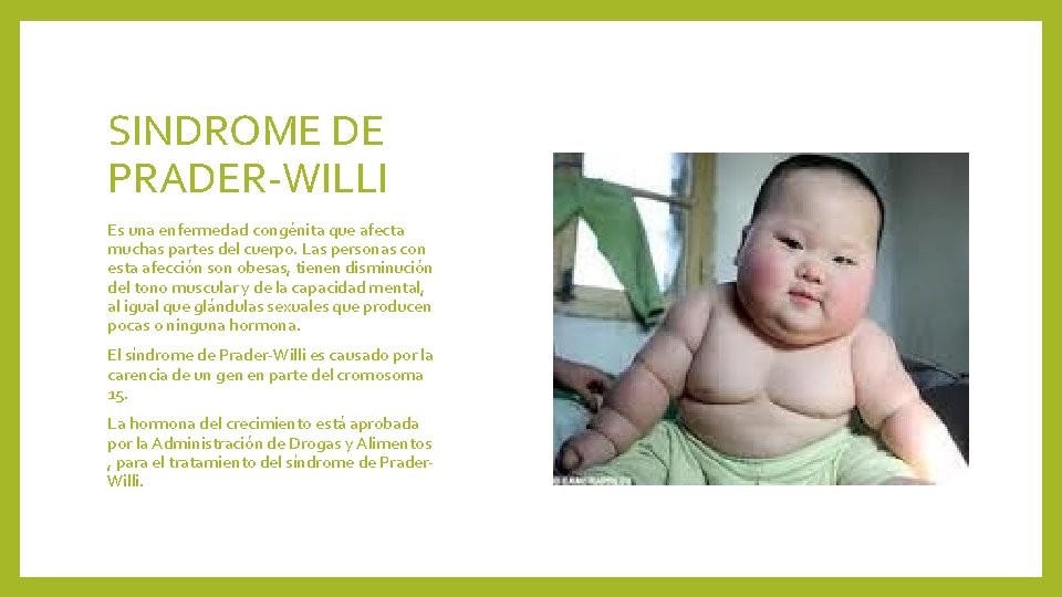 SINDROME DE PRADER-WILLI Es una enfermedad congénita que afecta muchas partes del cuerpo. Las